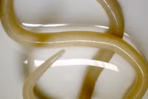 Sởn gai ốc với thế giới kỳ dị của các loài giun tròn 