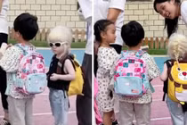 Cô bé bạch tạng khiến hàng triệu người Trung Quốc xúc động