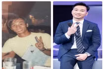 MC Thành Trung bị soi gương mặt quá khác lạ nghi do 'dao kéo'