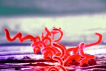 Động trời vụ Mỹ truyền bệnh giang mai cho tù nhân Guatemala 