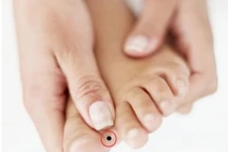 4 nốt ruồi ở chân là điềm may mắn, ai sở hữu dễ giàu sang