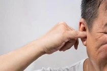 Ngứa liên tục ở 3 chỗ trên cơ thể, đừng nghĩ là dị ứng