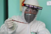 Rút nhóm chuyên gia về xét nghiệm của Bộ Y tế từ Đà Nẵng về hỗ trợ Hà Nội