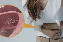 Những dấu hiệu cảnh báo đến lúc bạn cần sổ giun