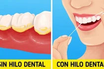 Giảm ngay mùi hôi miệng nhanh chóng với những cách đơn giản này 