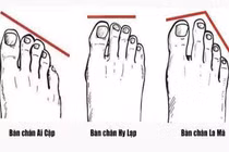 Nhìn độ dài ngón chân cái 3 giây biết ngay tương lai giàu nghèo 