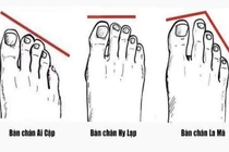 Nhìn độ dài ngón chân cái 3 giây biết ngay tương lai giàu nghèo 