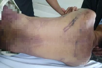 Công an tỉnh Bà Rịa-Vũng Tàu thông tin vụ phạm nhân bị đánh chết trong trại giam 