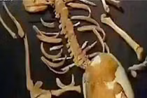 Giật mình thi thể trong mộ cổ 7.000 tuổi: Sao thừa 18 cái xương? 