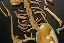 Giật mình thi thể trong mộ cổ 7.000 tuổi: Sao thừa 18 cái xương? 