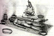 Bí ẩn chưa có lời giải dịch bệnh “nước tiểu đen” giết 15 triệu người