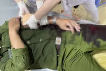 Thượng úy cảnh sát bị chém trọng thương khi làm nhiệm vụ 