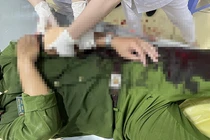 Thượng úy cảnh sát bị chém trọng thương khi làm nhiệm vụ 