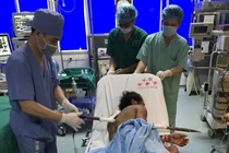 Cứu thành công ca tai nạn hi hữu, xà beng dài 1m đâm xuyên ngực