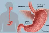Dấu hiệu nhận biết rõ nhất về ung thư dạ dày