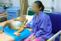 Sốc nhiều bé trai bị sùi mào gà sau khi cắt bao quy đầu