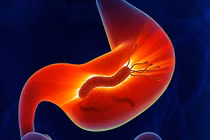 Đánh bay cơn đau dạ dày đơn giản, an toàn chỉ trong nháy mắt