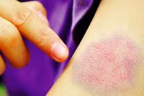  Thấy da thế này đi khám ngay kẻo tới lúc bán nhà cũng chẳng cứu được