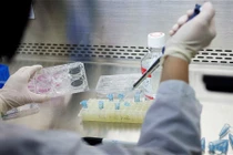 Tế bào gốc được sử dụng trong thẩm mỹ như thế nào