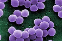  Tụ cầu vàng: "đương kim vô địch" kháng thuốc kháng sinh