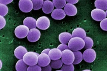  Tụ cầu vàng: "đương kim vô địch" kháng thuốc kháng sinh