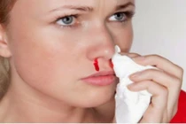 Những triệu chứng của ung thư các xoang mặt