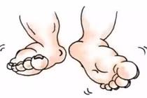 Ăn gì để trị dứt điểm chứng tỳ hư, phù thũng?