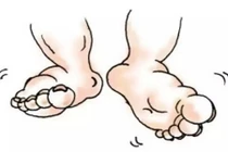 Ăn gì để trị dứt điểm chứng tỳ hư, phù thũng?