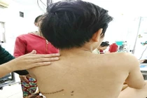 Bé trai bị bạn phóng kéo đứt động mạch chủ, mất gần 2 lít máu