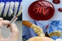 Điểm mặt những vụ công an, bác sĩ phơi nhiễm HIV kinh hoàng ở VN