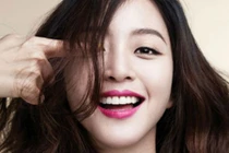 8 điểm cần lưu ý trước khi làm trắng răng 