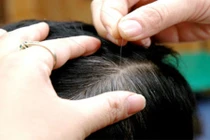 4 bài thuốc chữa tóc bạc sớm đặc biệt hiệu quả 