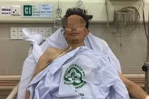 Cứu sống ngoạn mục bệnh nhân hôn mê sâu do hen phế quản 