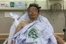 Cứu sống ngoạn mục bệnh nhân hôn mê sâu do hen phế quản 