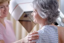 Nguyên nhân nào dẫn đến bệnh ung thư vú?