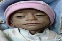 Cảnh trẻ nhỏ chết đói đau lòng tại TP Deir Ezzor, Syria