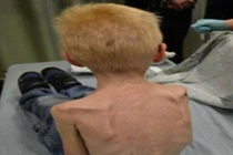 Phẫn nộ bà mẹ kế bạo hành con riêng như “thời trung cổ”