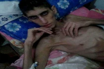 Khủng hoảng nhân đạo ở Syria qua ảnh