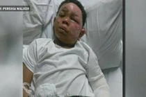 Sốc nguyên nhân khiến bé 7 tuổi “tự thiêu” ở Mỹ