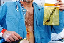 Hoảng hồn những thứ kinh dị nằm trong cơ thể con người