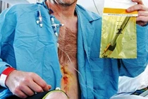 Hoảng hồn những thứ kinh dị nằm trong cơ thể con người