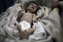 Nhói lòng thảm cảnh của trẻ em Syria do khủng hoảng lương thực