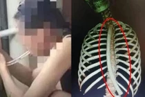 Cô gái học mẹo giảm cân trên mạng, gặp cái kết nhớ đời 