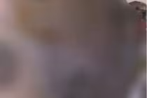 Chỉ vì cả tin, bầu ngực 1 phụ nữ ở Vĩnh Long biến dạng đáng sợ 