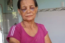 Con dâu đánh mẹ chồng tím mặt ở Bình Phước: Phạt 2 triệu đồng