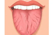 Có dấu hiệu này ở lưỡi, coi chừng mắc bệnh chết người 