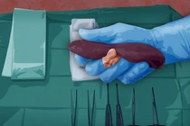 Rợn người cảnh bán thận ở chợ đen