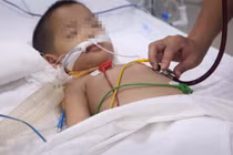 Bé 3 tuổi nguy kịch do biến chứng tay chân miệng