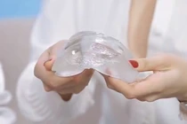 Bác sĩ nói gì về khả năng vỡ túi ngực khi đi máy bay?