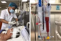 Kỳ tích cứu sống bệnh nhân 18 tuổi đột quỵ não nặng, hôn mê sâu